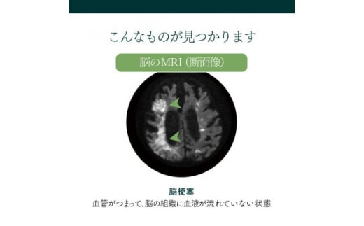 身体の健康診断を受けるなら、脳の状態も知っておいた方がいい!約30分で終わる日帰り脳ドック!【1450274】