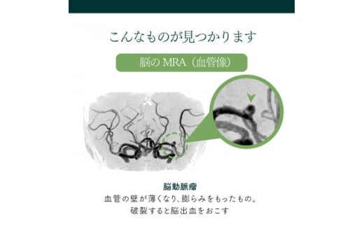 身体の健康診断を受けるなら、脳の状態も知っておいた方がいい!約30分で終わる日帰り脳ドック!【1450274】