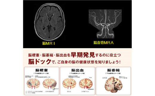 脳ドック（Aプラン）　脳梗塞・脳腫瘍・脳出血の早期発見【まつだ整形外科クリニック】