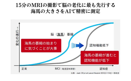 AIとMRIを利用した認知症予防ドック | MRI 脳ドック 認知症予防 日帰り 健康診断 検診 埼玉県 草加市